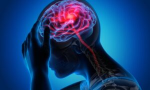 Drawing of a person holding their head in pain. You can see their brain and a red stream of light filling their brain and oozing down their spinal column. This light is meant to represent the pain and other symptoms associated with migraines. 